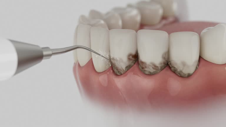 Trusted Invisalign Clear Aligners service in Annetta, TX - Dentist Open Now